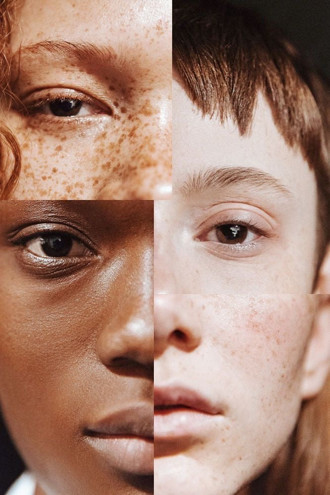 Your Path to Clearer Skin Starts Here